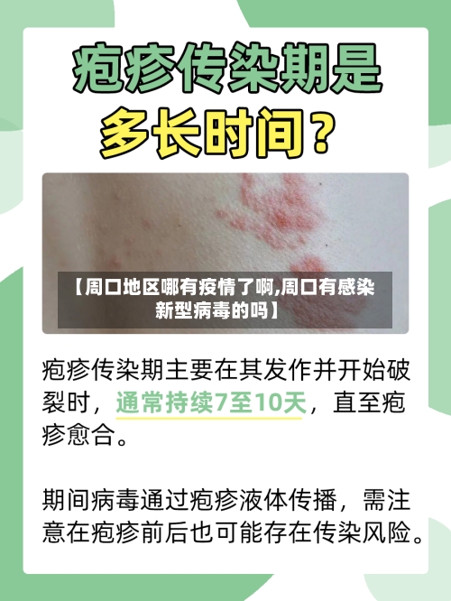 【周口地区哪有疫情了啊,周口有感染新型病毒的吗】-第2张图片