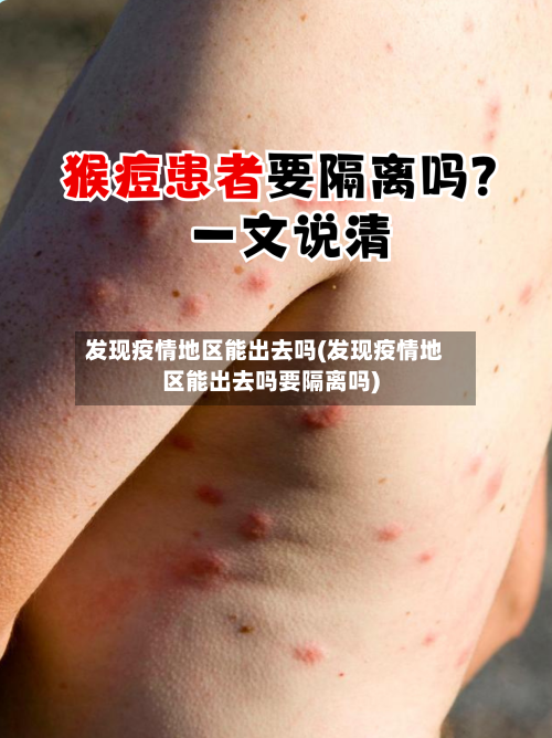 发现疫情地区能出去吗(发现疫情地区能出去吗要隔离吗)-第3张图片