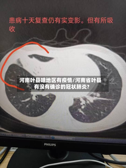 河南叶县啥地区有疫情/河南省叶县有没有确诊的冠状肺炎?-第3张图片